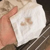 Alternative view of Miracle Stain Remover Spray